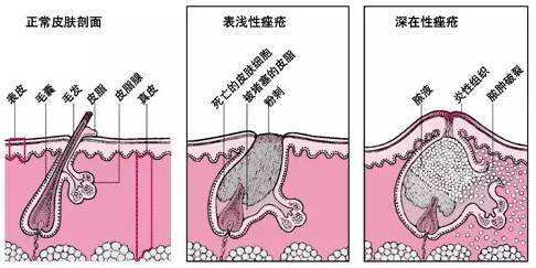 治療痤瘡的最好醫(yī)院,治療痤瘡的最好醫(yī)院，系統化分析與說明,科學解答解釋定義_進階版18.44.30