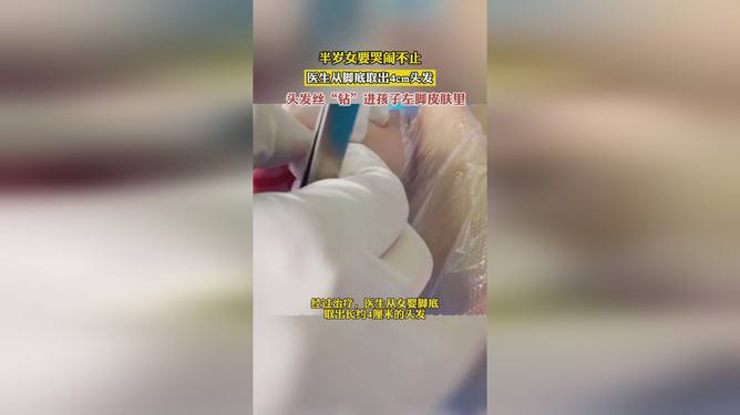 女?huà)雰商炜摁[不止竟因頭發(fā)絲繞腳趾